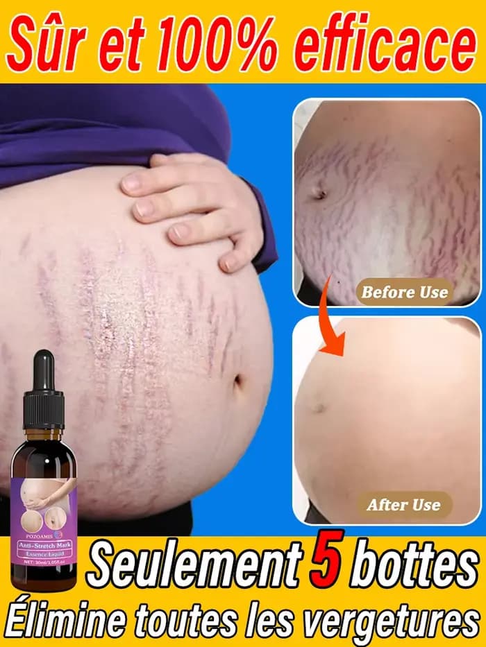 Huile essentielle corporelle adaptée aux femmes enceintes, élimine les vergetures, hydrate et apaise la peau